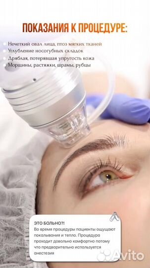 Микроигольчатый RF лифтинг