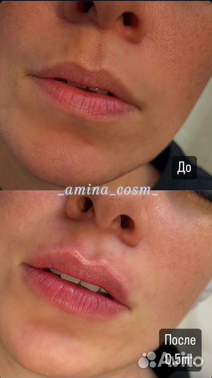 Услуги косметолога