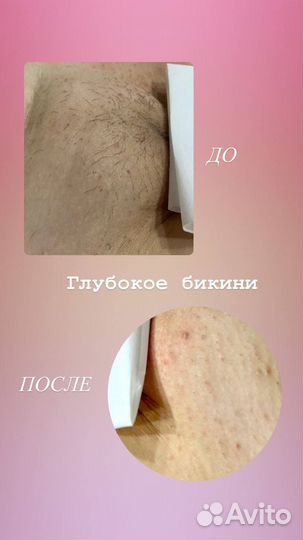 Мастер депиляции Кубинка