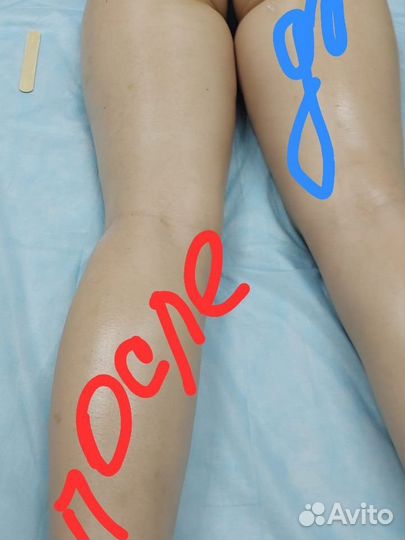 Аппаратный и ручной массажи