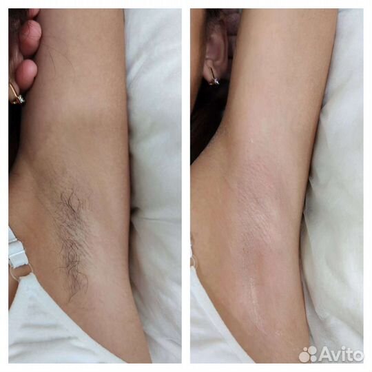 Шугаринг / Восковая Депиляция / Курчатовский район