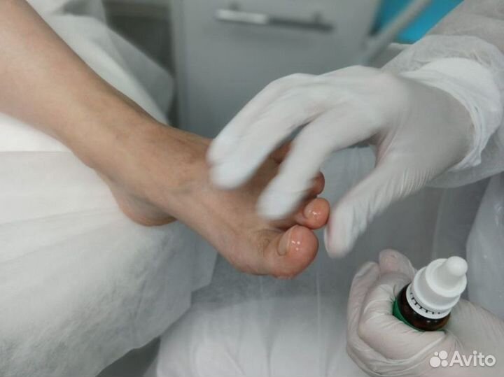 Медицинский педикюр от подолога