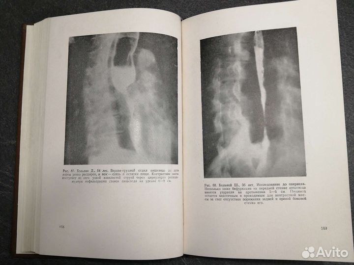 Хирургия вегетативной нервной системы 1947г