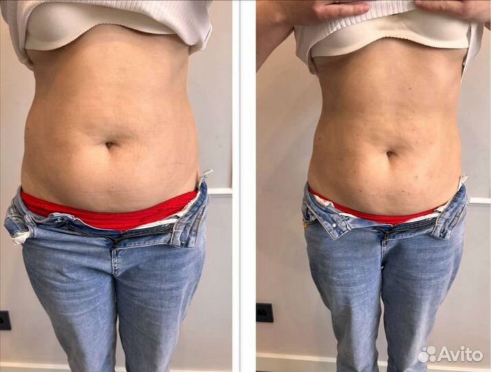 Супер сушка живота