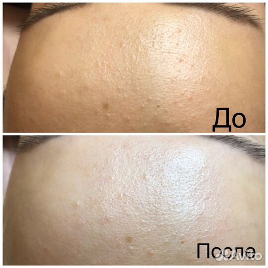 Уходовые процедуры