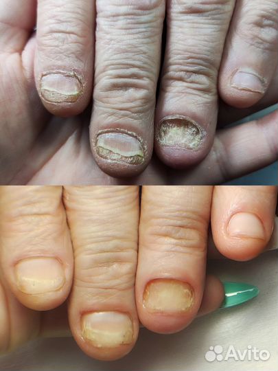 Наращивание ногтей
