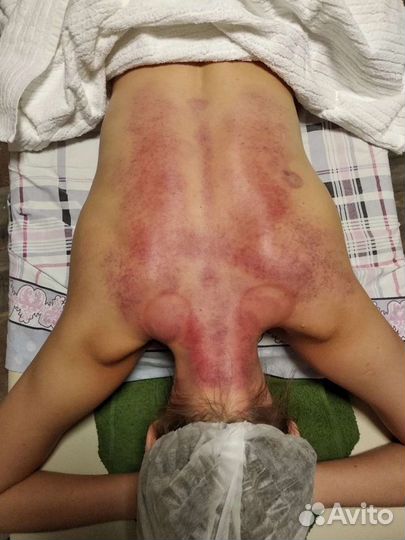 Кинезиолог, массажист