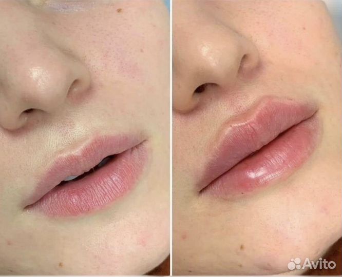 Косметология модели бесплатно