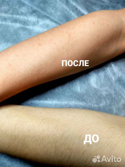 Спа-депиляция (сахар,воск), Кривко, Сосново