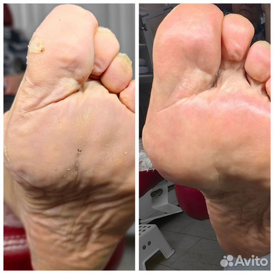 Мастер педикюра