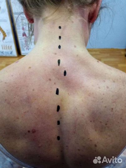 Массажист- костоправ