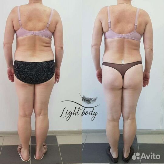 Lpg массаж, Лазерная эпиляция, RF лифтинг и др