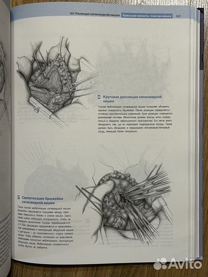 Атлас общей хирургии Шумпелик