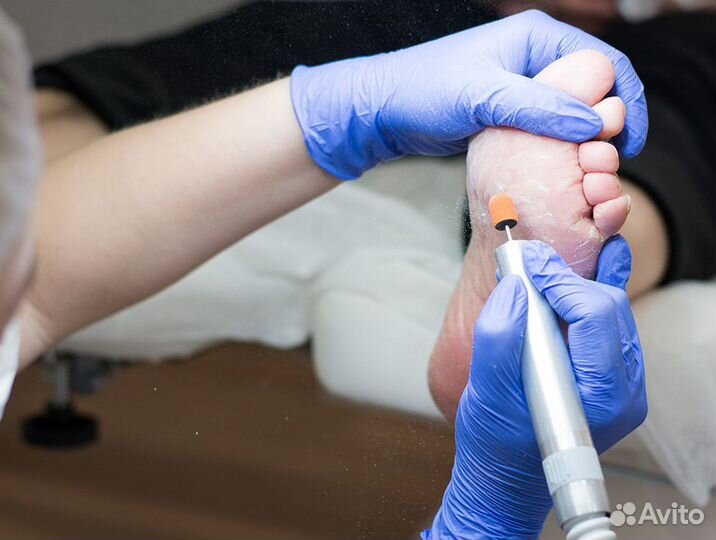 Парамедицинский педикюр - Подолог