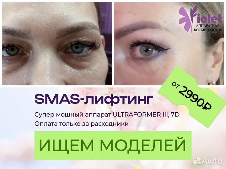 Аппаратная косметология