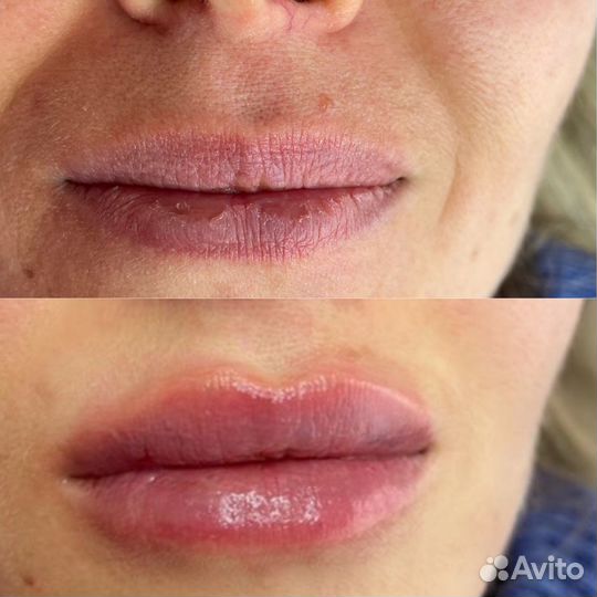 Услуги косметолога