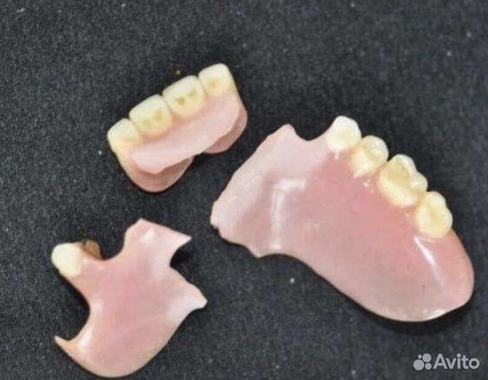 Ремонт, чистка зубных протезов