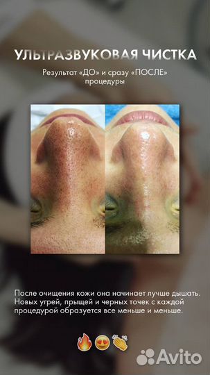 Чистка Лица/Татуаж бровей