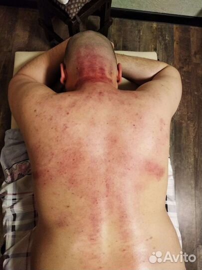 Кинезиолог, массажист