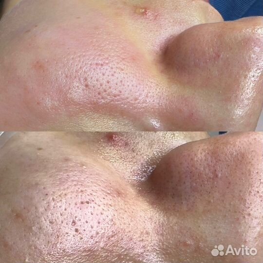 Мастер по наращиванию ресниц, косметолог