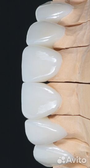 Коронки цирконевые, виниры, зубы на имплантах