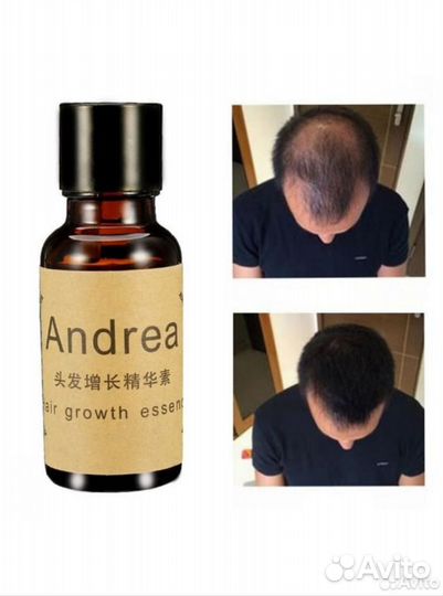 Сыворотка против выпадения волос