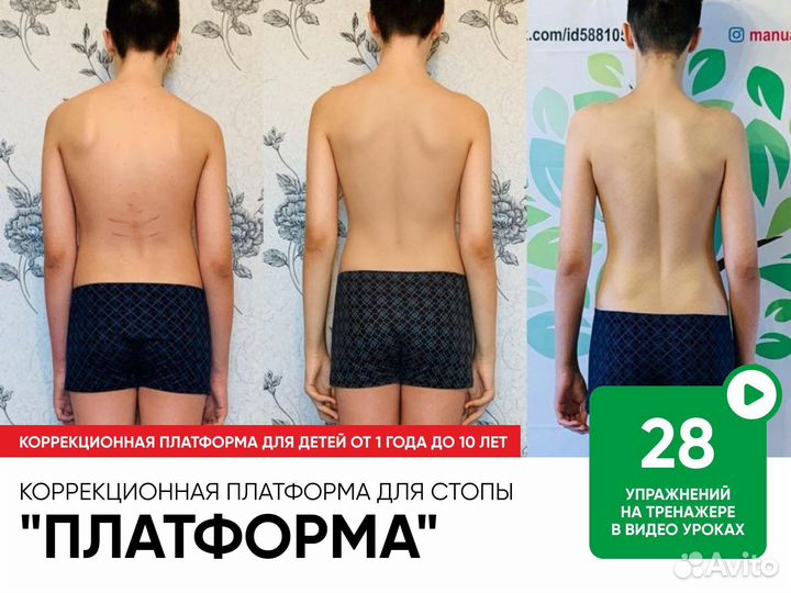 Коррекционный оздоровительный тренажер для стопы