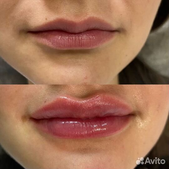 Услуги косметолога