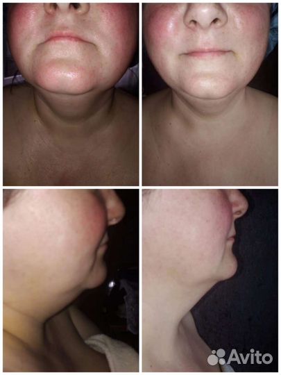 Услуги массажистки