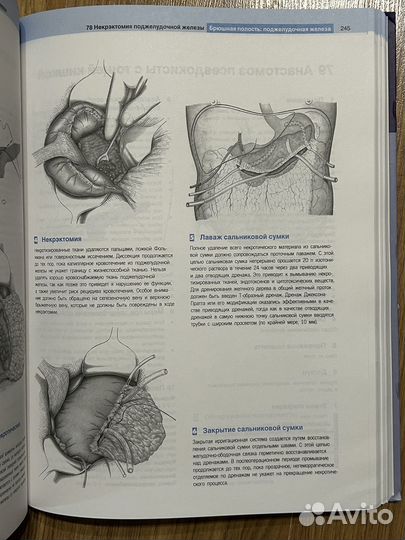 Атлас общей хирургии Шумпелик