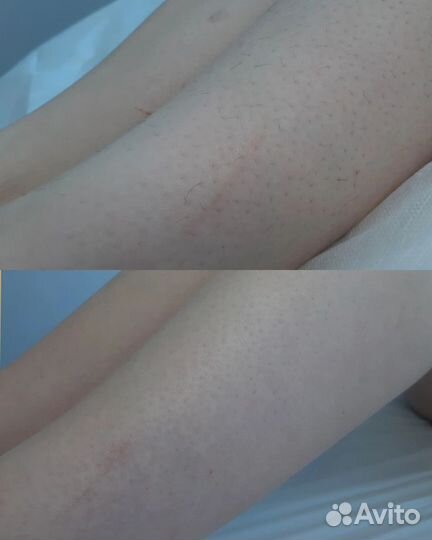 Шугаринг/Ваксинг