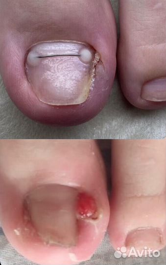 Обучение подологии, педикюру и маникюру