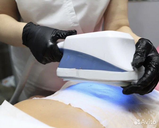 Криолиполиз, похудение