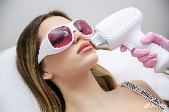 Лазерная эпиляция