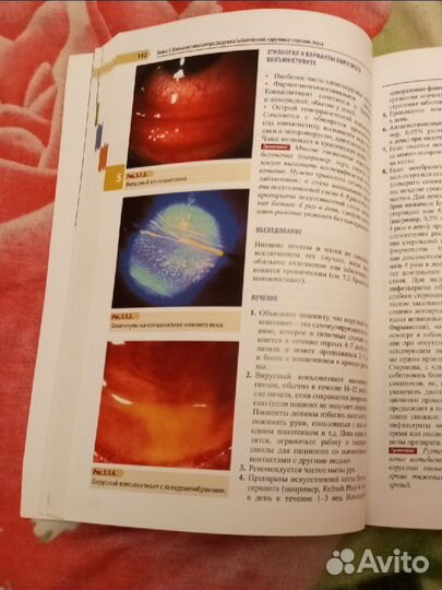 Офтальмология.Руководство. Под ред Элерса и Шаха