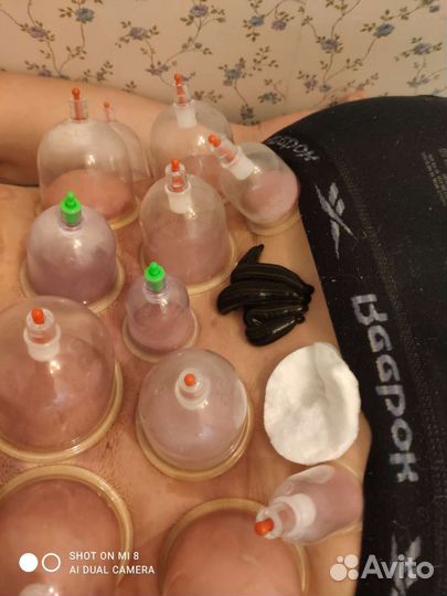 Гирудокосметология