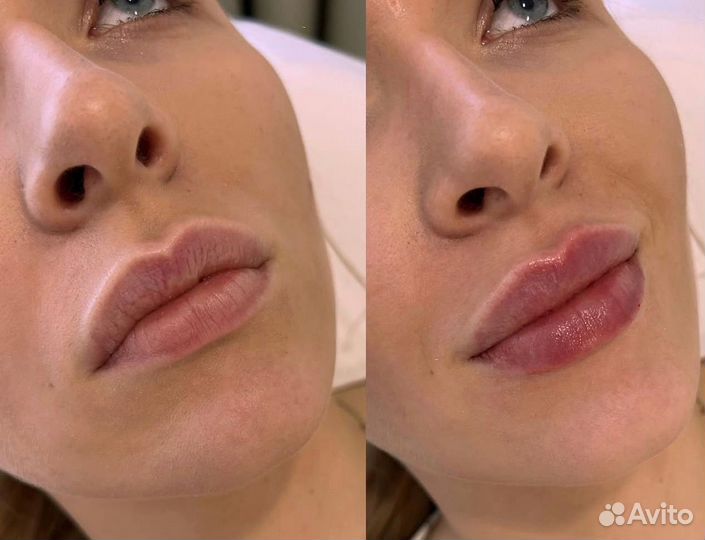 Врач косметолог