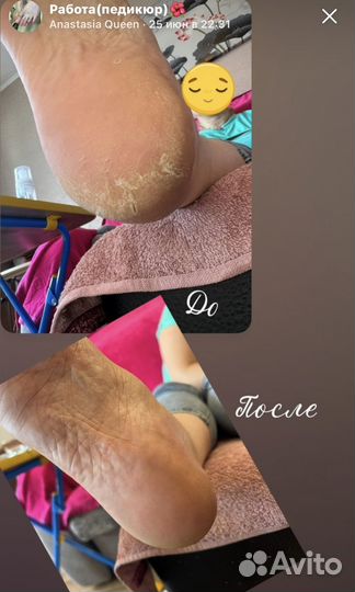 Педикюр на дому