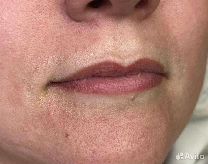 Услуги косметолога