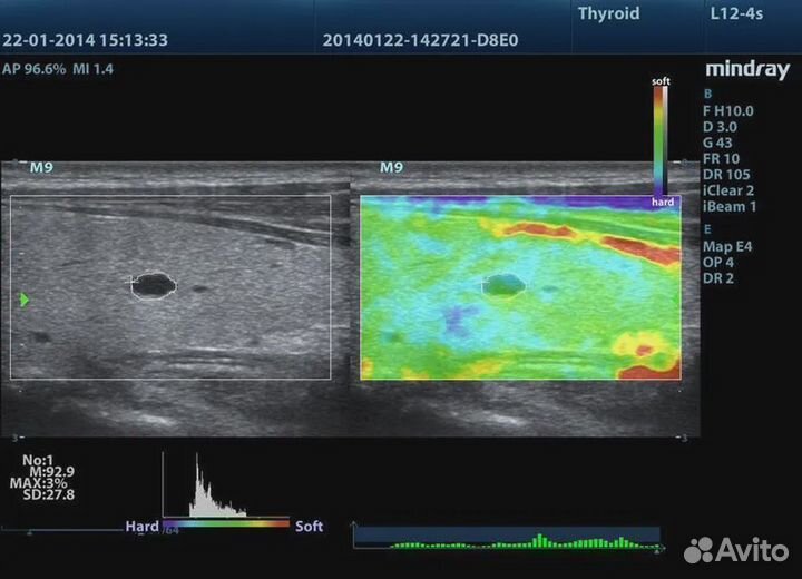 Узи аппарат Mindray M8