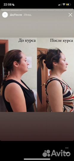 Хиромассаж Лица, Тела, Головы, Антистресс терапия