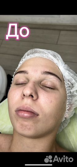 Косметолог чистка лица пилинги