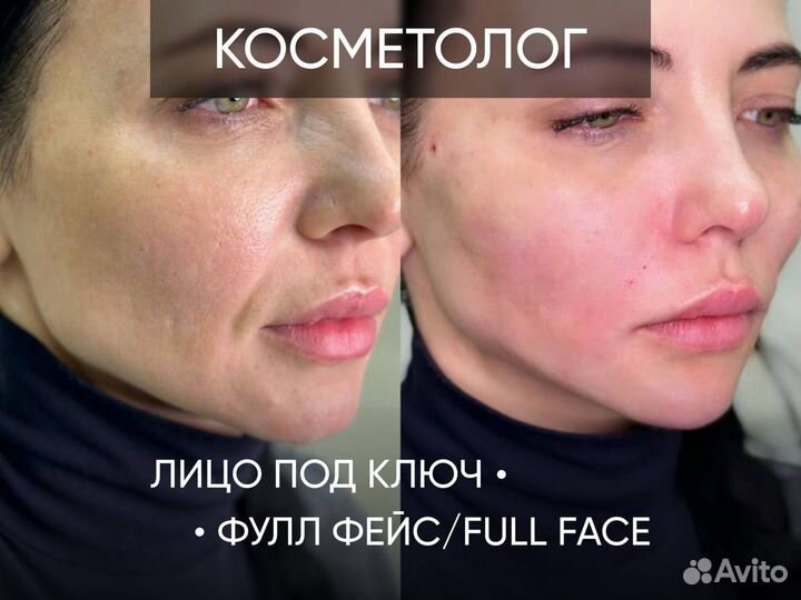 Лицо под ключ (фул фейс). Косметолог