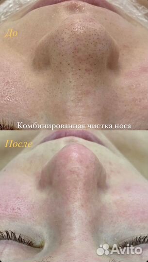 Косметолог, массаж