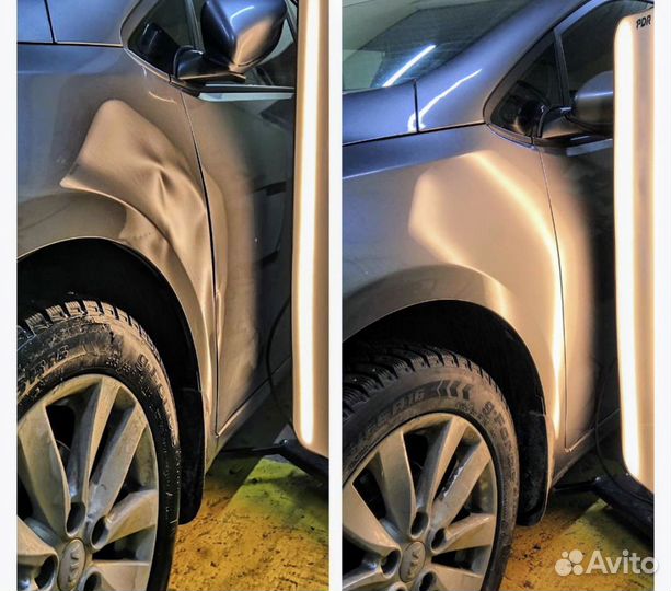 Вакуумная рихтовка (выпрямление вмятин )