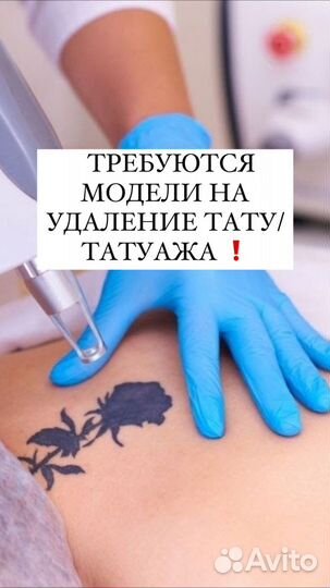 Требуются модели на удаление татуажа
