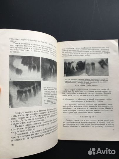 Показания к удалению зубов у детей, Медгиз,1962