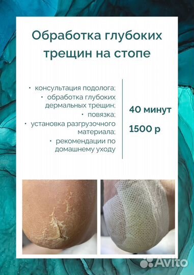 Педикюр подолог Омск Амур