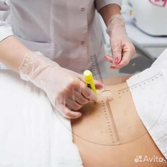 Мгновенное похудение. Липосоникс. Липосакции