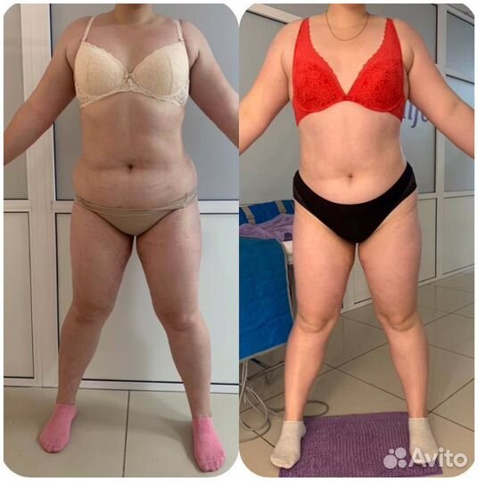 Коррекция фигуры и омоложение 7в1